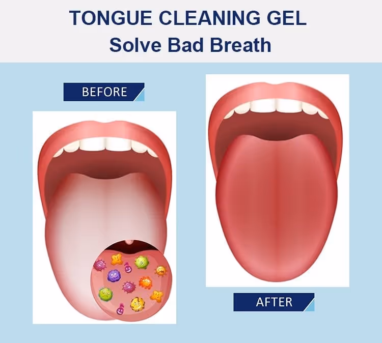 Tongue Cleaning Gel Set